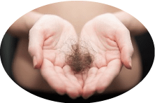Hair loss