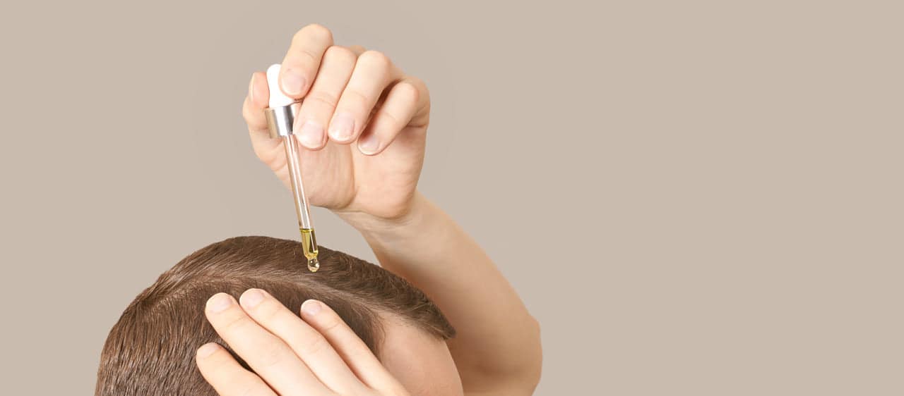 minoxidil_apllication Hair Loss Treatments: Are they effective, and how much do they cost?