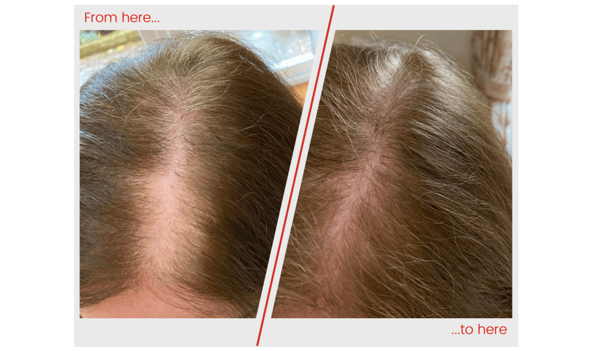 Hair image