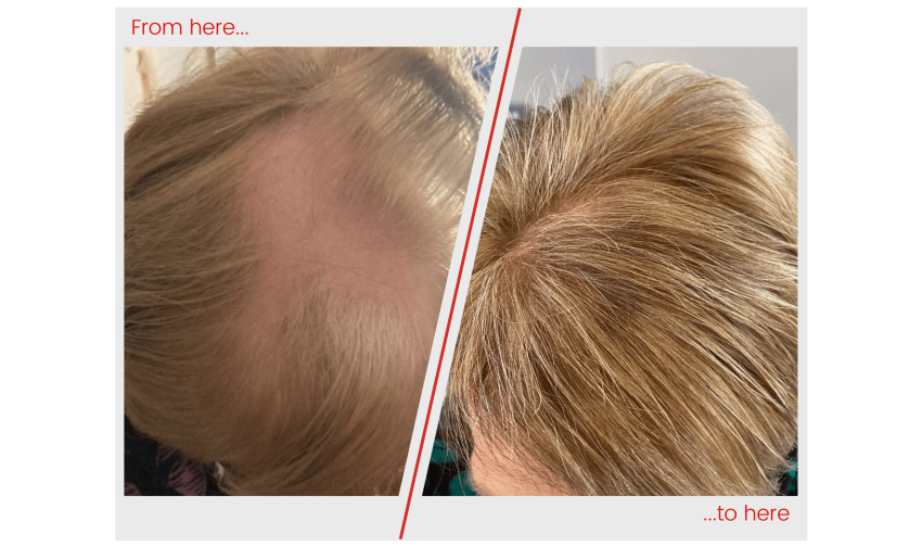 Hair image