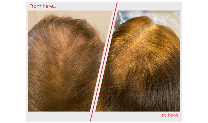 Hair image