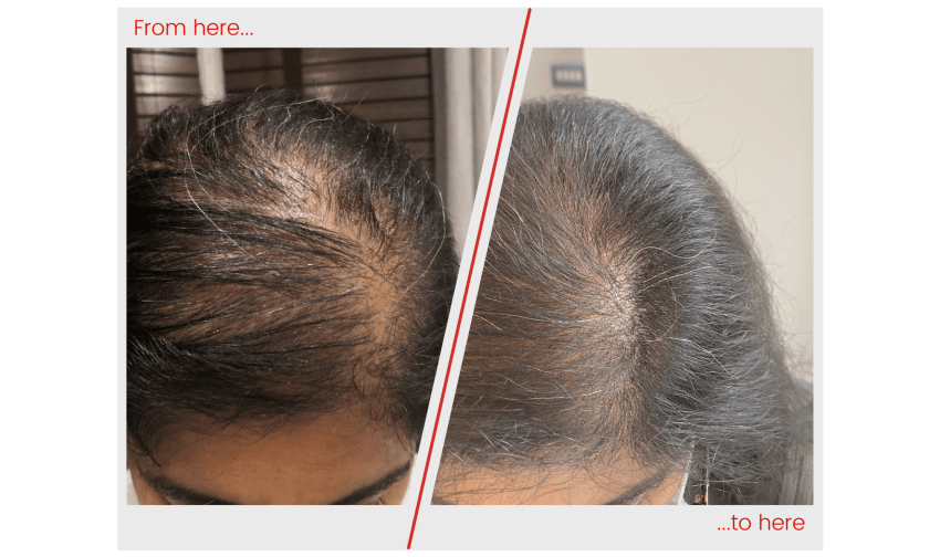Hair image