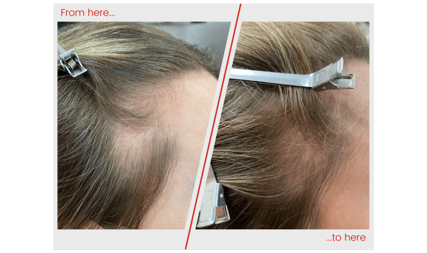 Hair image
